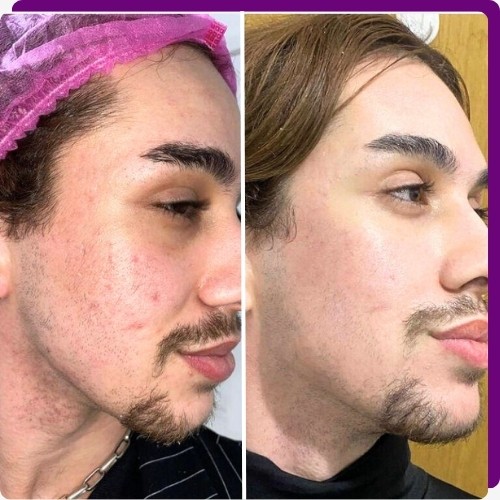 Como funciona o tratamento?