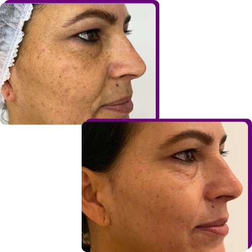 Como funciona o tratamento