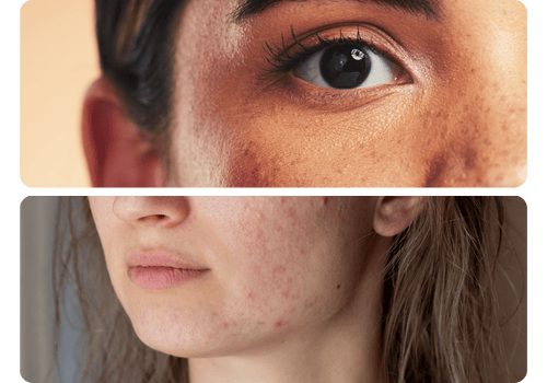 Saiba quais são as indicações