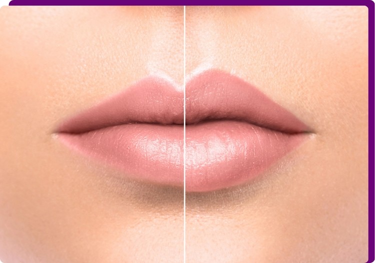 Como é realizado o procedimento?